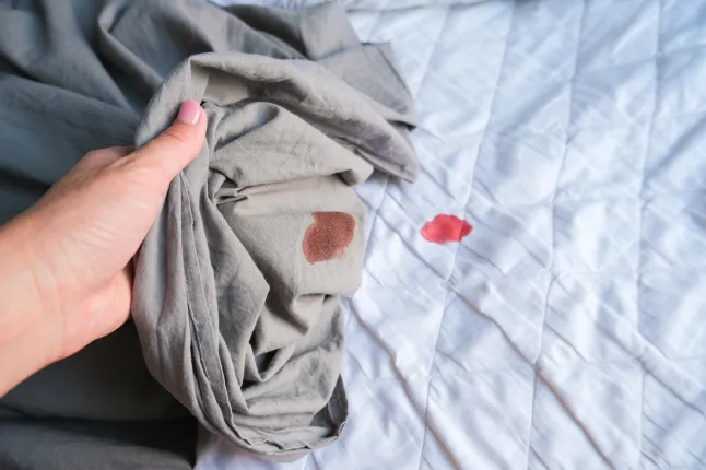 Vereplekk hallil linal/valgel madratsikattel (Pilt: Getty Images)