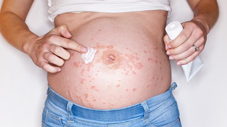 What is Implantation Bleeding and When Does It Occur?