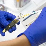 What is Implantation Bleeding and When Does It Occur?