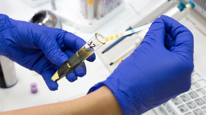 What is Implantation Bleeding and When Does It Occur?