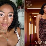 Yasmini vitiligo kujutis filmis Love is Blind võib elusid muuta